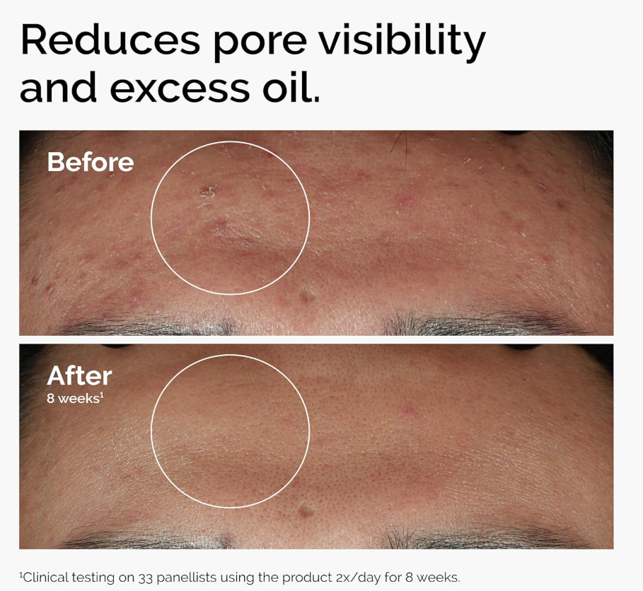 Radiant Pomegranate Glow Serum™